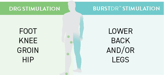 abbott medical spinal cord stimulation field shaping