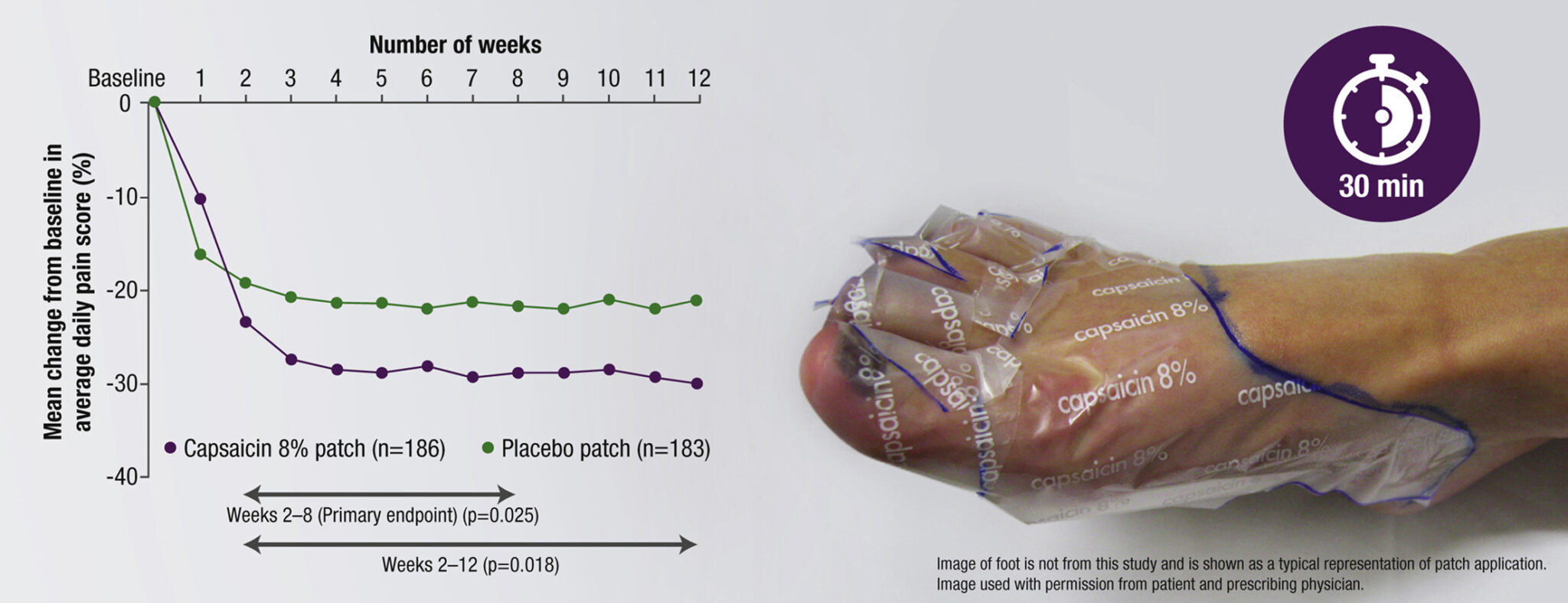 QUTENZA® (CAPSAICIN) 8 PATCH Pain Specialists of Southern Oregon